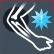 Tennisarm